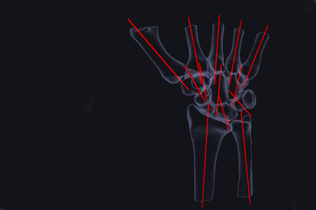 Wrist_3D imaging